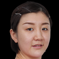  万次挥拍背后的生理极限：职业运动员伤病应对与心理重构机制 体育新闻